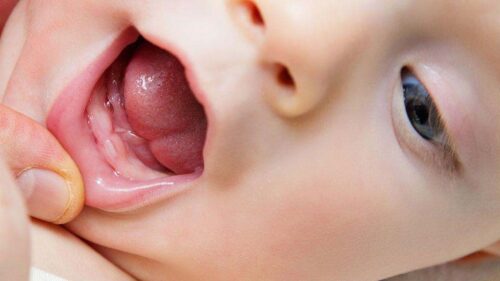 نشانه های رویش دندان در نوزادان