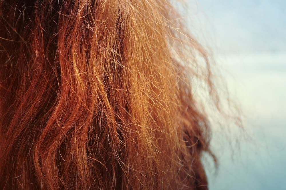 ۸ راه حل طبیعی معجزه آسا برای درمان وزی مو در خانه