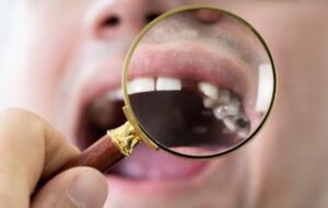 علت لق شدن دندان ها در بزرگسالی و چند روش برای درمان آن
