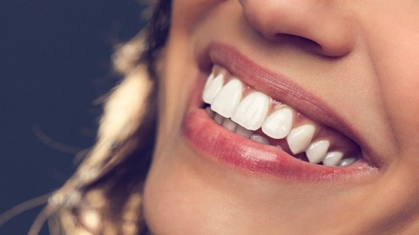 چند روش طبیعی و کم هزینه برای سفید کردن دندان ها